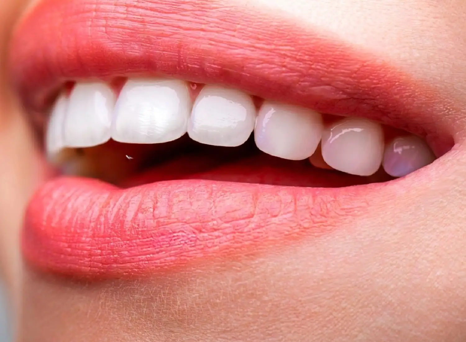 ¿Es seguro el blanqueamiento dental?