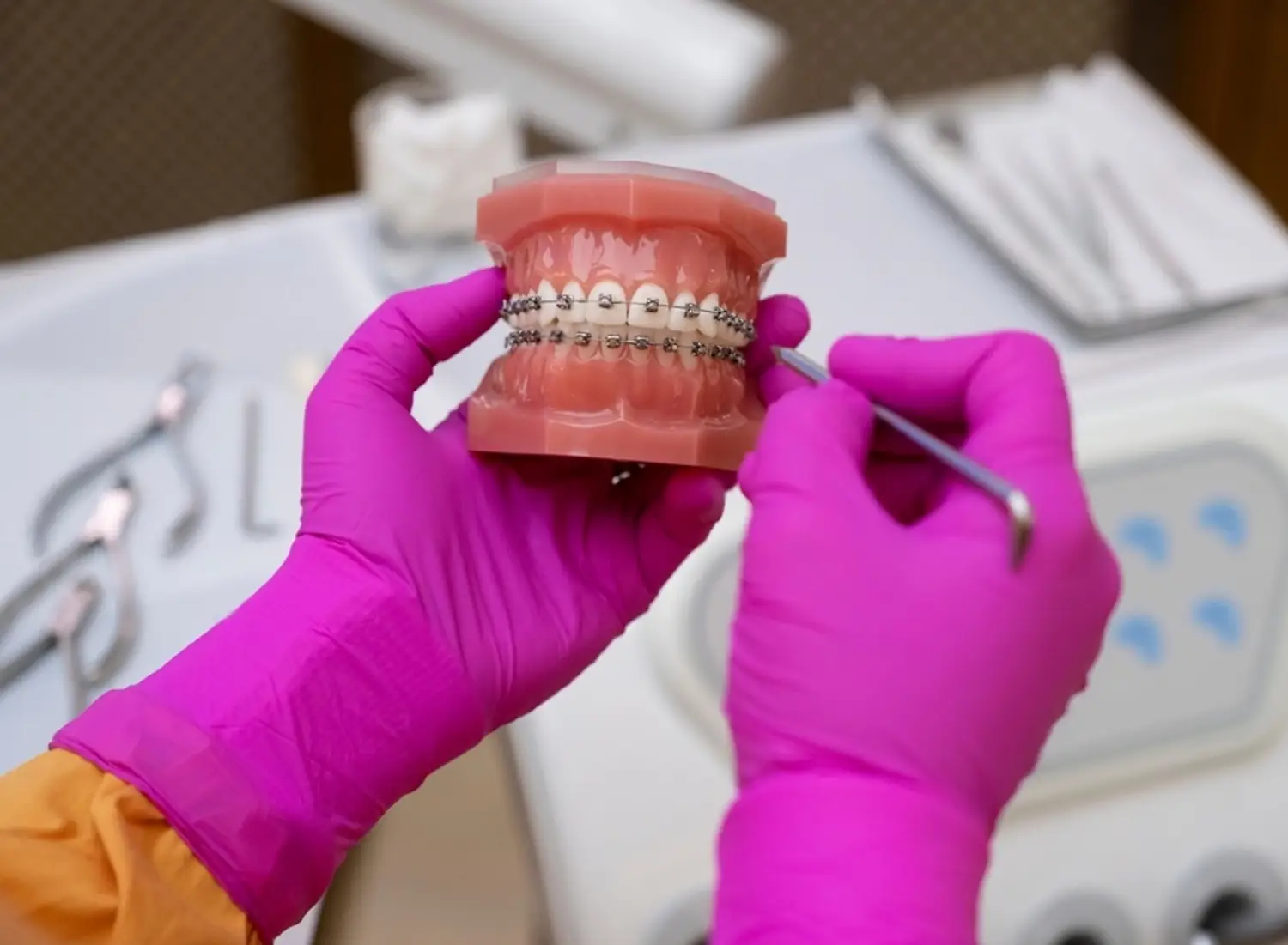 Frequently Asked Questions About Orthodontics in Palma de Mallorca