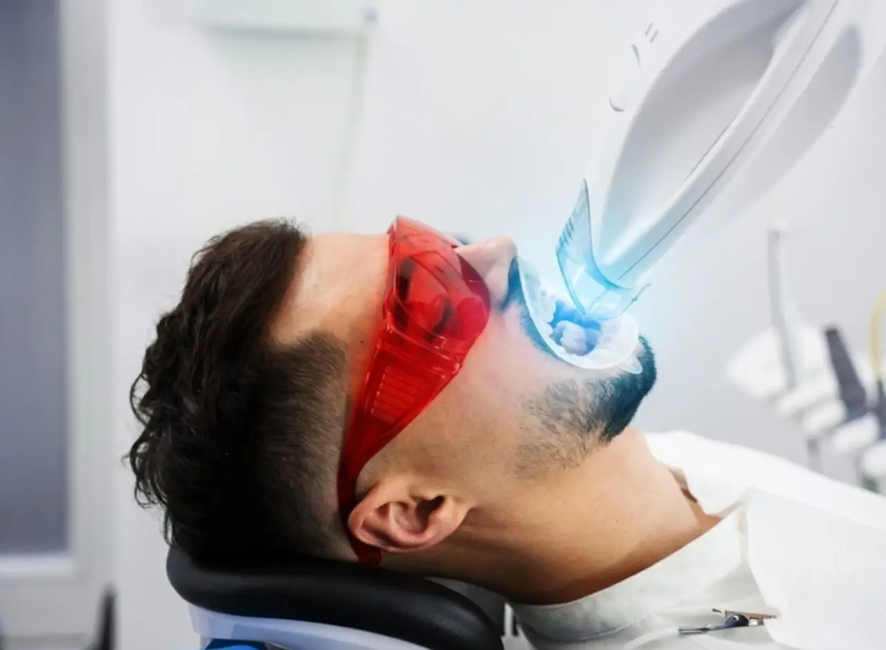 What type of teeth whitening is most effective?