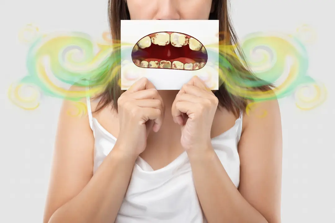 ¿El mal aliento viene de los dientes o del estómago?