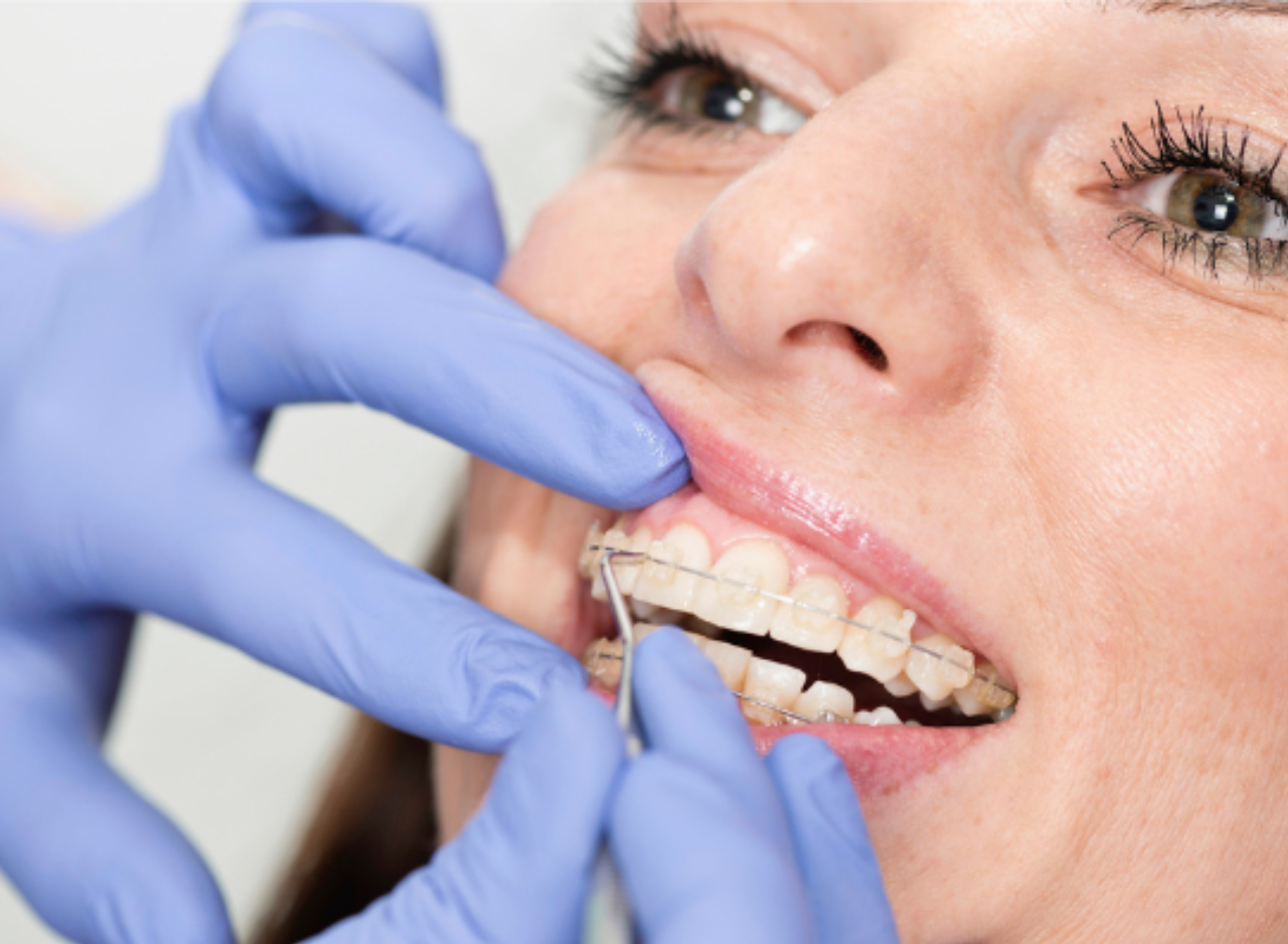 Orthodontic emergencies: how to act in every situation